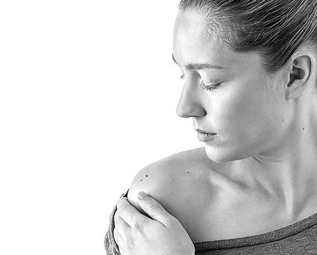 How to Conduct a Skin Care Self-Exam