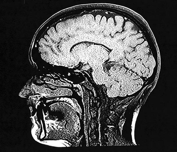 5 New Year’s Resolutions to Benefit the Brain